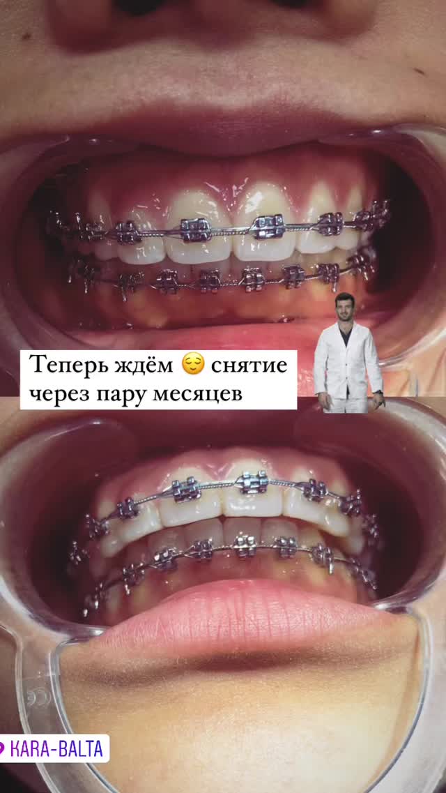 Лечение зубов