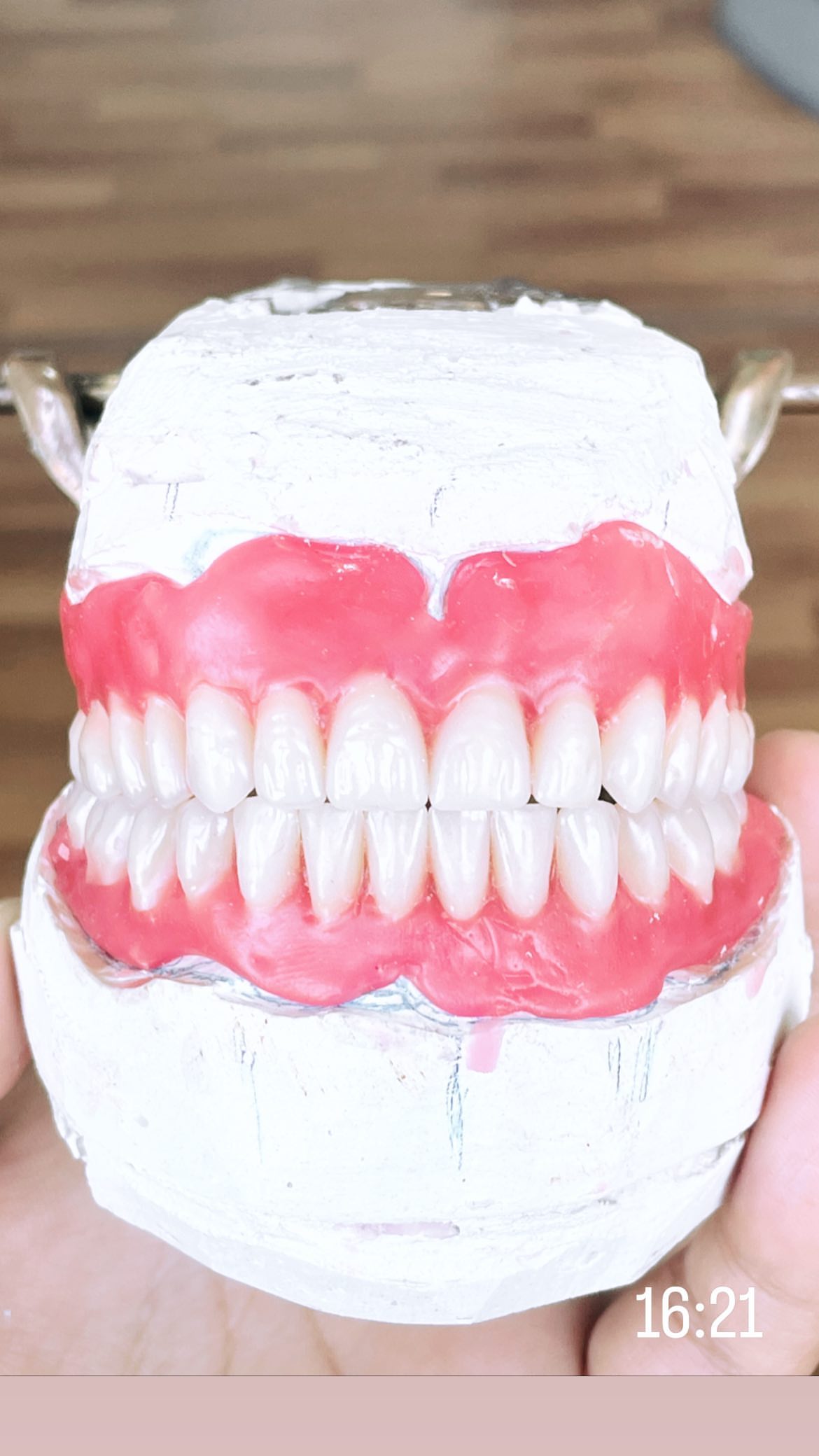 Протезирование