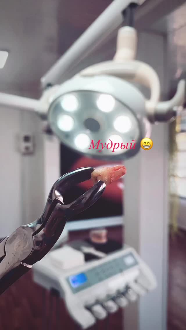 Удаление зубов